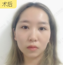 4-221019201ZT39.png
