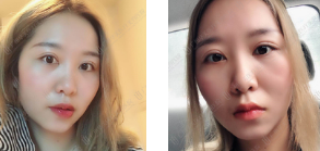 4-221019201S0A1.png