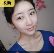 -1-1Q1251952414I.png.jpg