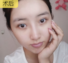 -1-1Q125195250P2.png.jpg