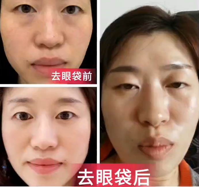 4-230S112311B02.png.jpg