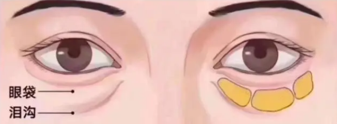 4-24042910494G53.png.jpg